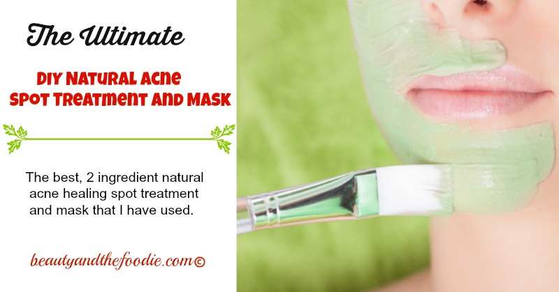 Ultimate Natural Acne Spot Treatment and Mask. beautyandthefoodie.com