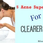 Five Acne Super Tips For Clearer Skin, #acnetips #clearskin