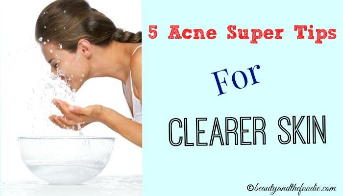 Five Acne Super Tips For Clearer Skin, #acnetips #clearskin